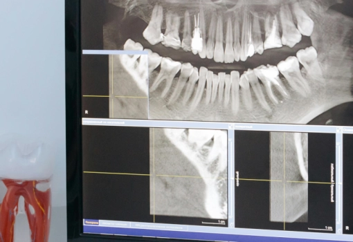 DIGITÁLIS KÉPALKOTÁS
